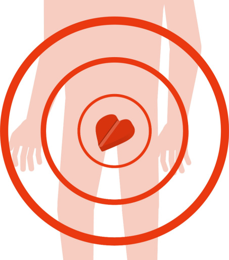 Erectile dysfunction treatment concept vector image