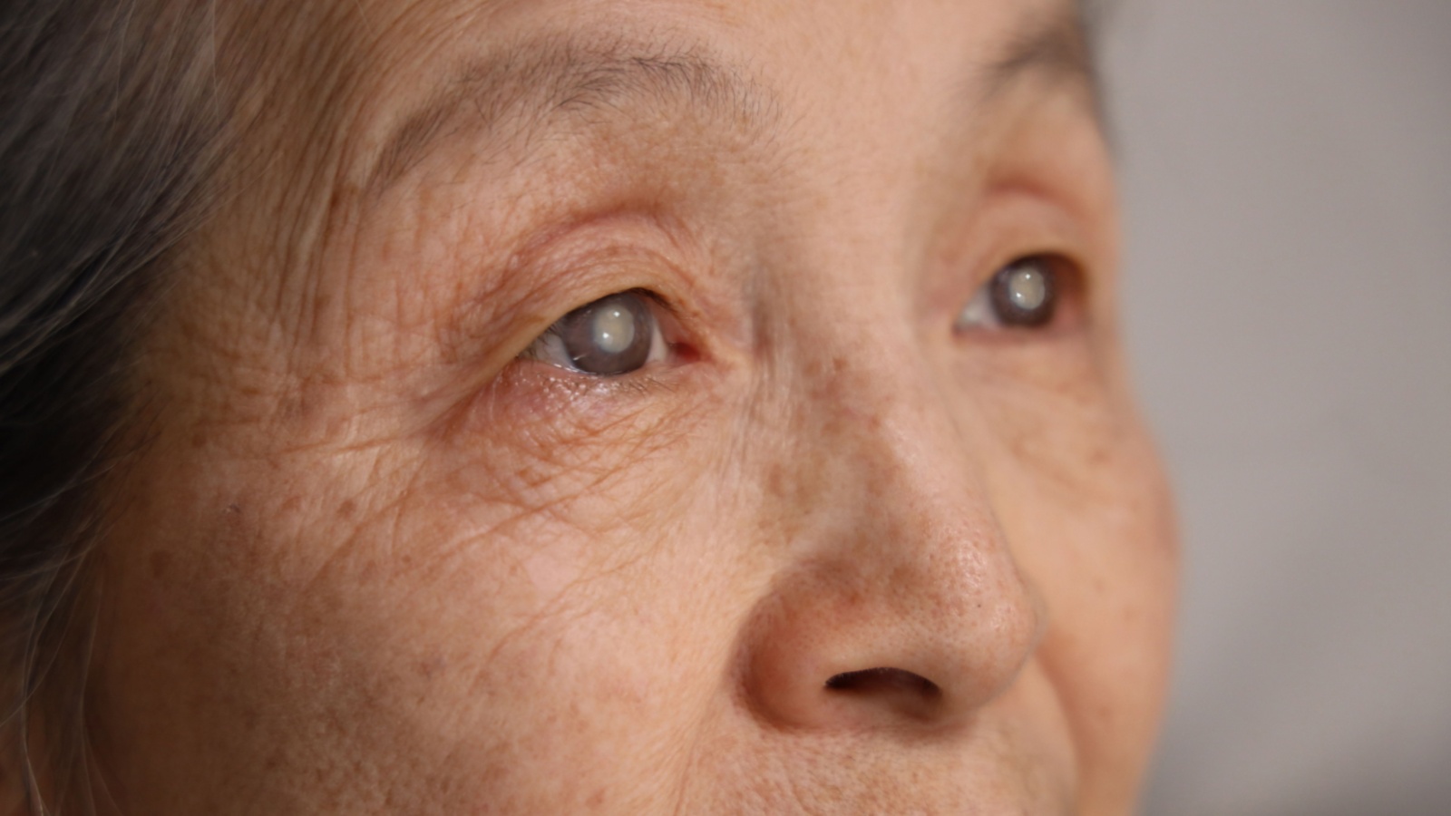 close-up of an elderly woman with cataracts