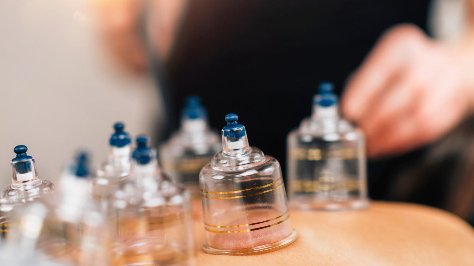 cupping therapy on patient's back