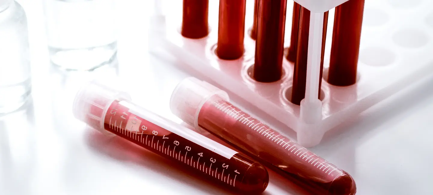 blood samples