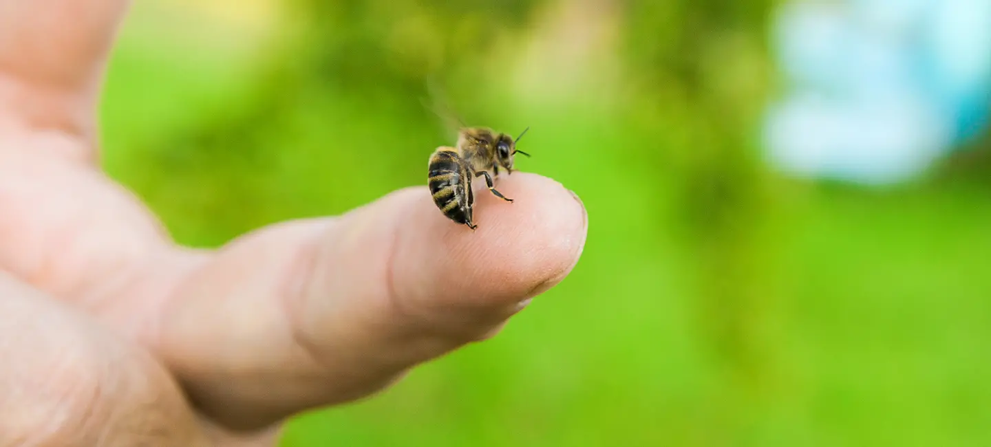 bee stinging a finger