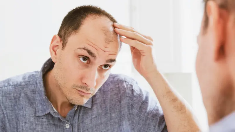 man looking at mirror worried about balding