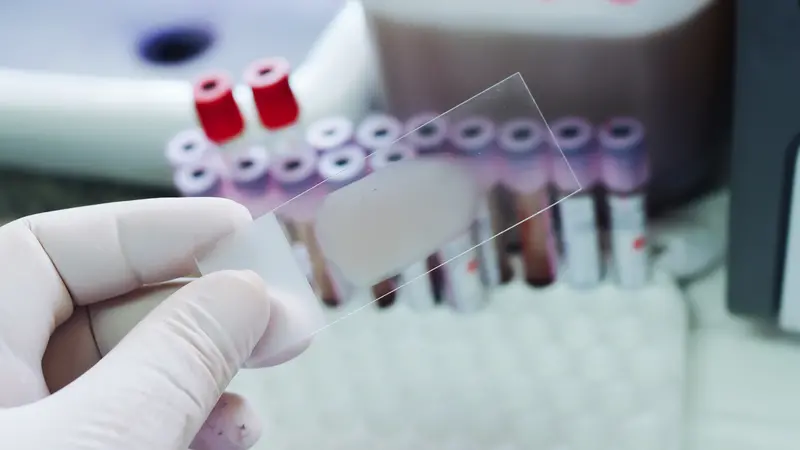Blood smear is non stain isolated on blood tube and slides bin background Blood smear is non stain isolated on blood tube and slides bin background