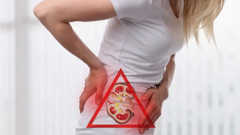 Kidneys stone pain Kidneys stone pain