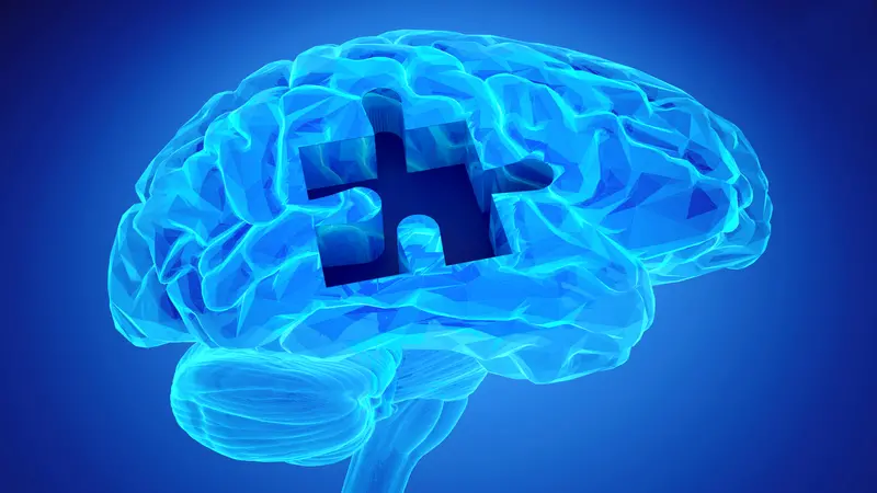 Human brain research and memory loss as symbol of Alzheimer's concept with missing pieces of the puzzle