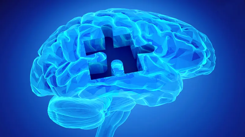 Human brain research and memory loss as symbol of Alzheimer's concept with missing pieces of the puzzle Human brain research and memory loss as symbol of Alzheimer's concept with missing pieces of the puzzle