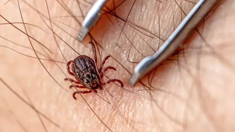 Removing of disease carrying tick from skin. 