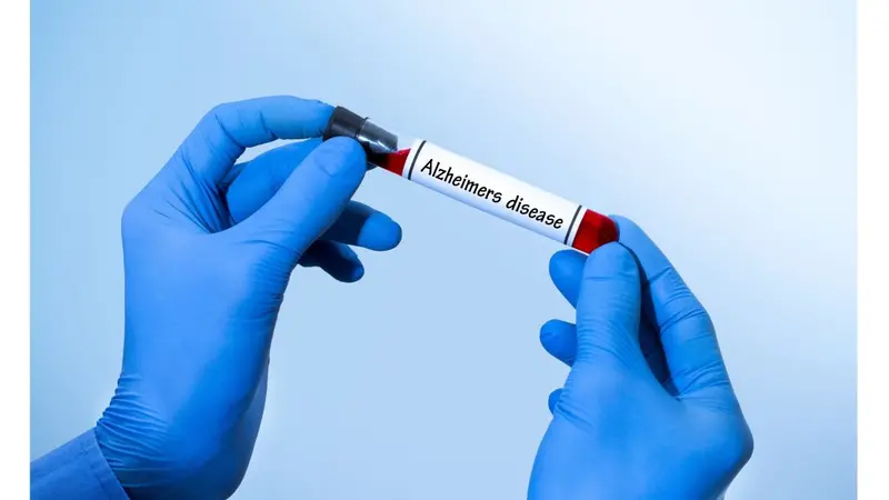 Holding blood test tube that says Alzheimer's disease Holding blood test tube that says Alzheimer's disease