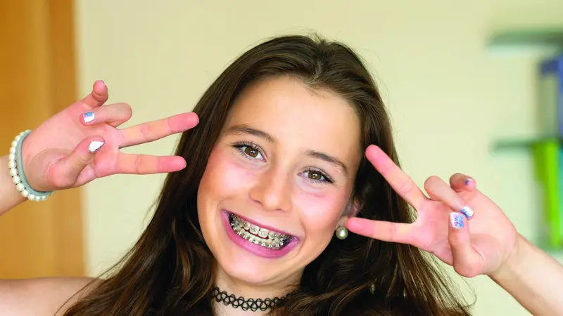 Teenage girl with braces smiling Teenage girl with braces smiling