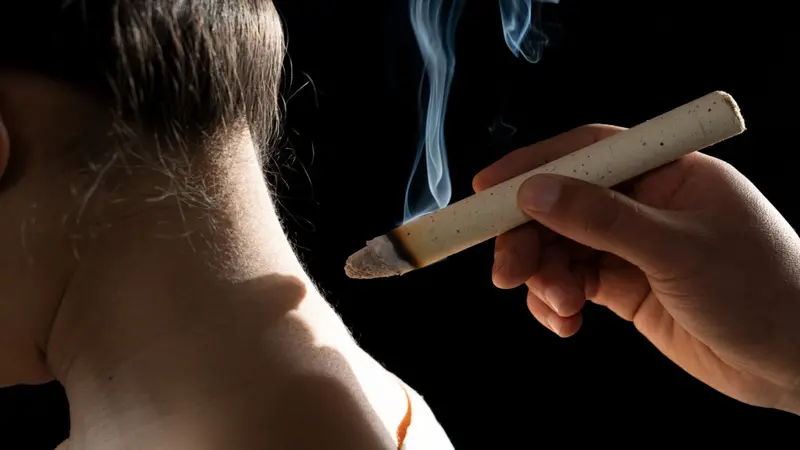 Person receives moxibustion to the back of their neck Person receives moxibustion to the back of their neck