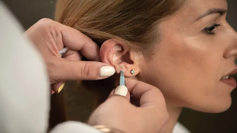 Woman receiving auricular acupuncture Woman receiving auricular acupressure