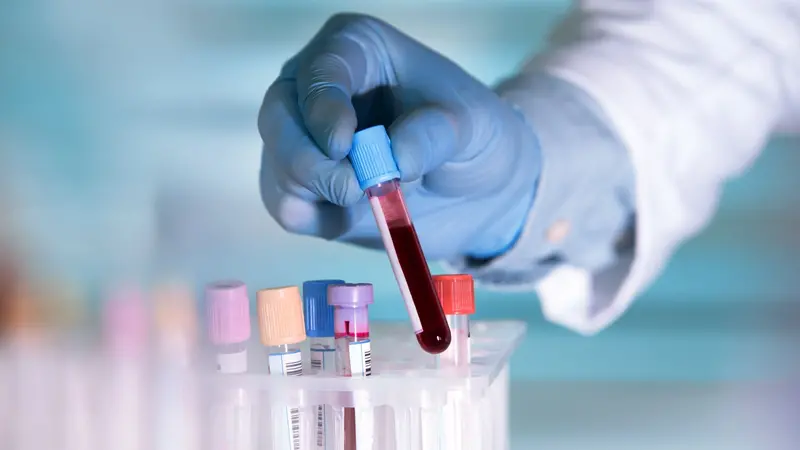 Lab technician holding blood tube sample for study Lab technician holding blood tube sample for study