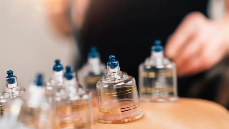 cupping therapy on patient's back