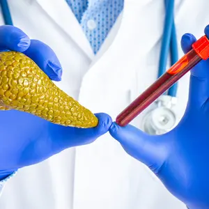 Doctor holds in one hand laboratory test tube with blood, in other figure of pancreas