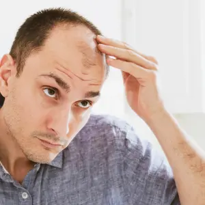 man looking at mirror worried about balding