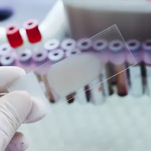 Blood smear is non stain isolated on blood tube and slides bin background Blood smear is non stain isolated on blood tube and slides bin background
