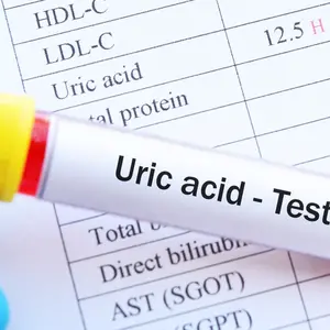 Blood sample tube with abnormal high uric acid test result