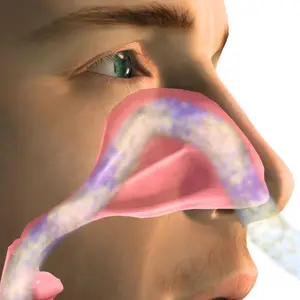 Nasal delivery of proteins 