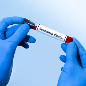Holding blood test tube that says Alzheimer's disease