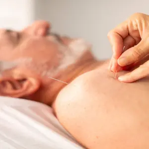 The hands of an acupuncturist places needles on the shoulder of an older man during an acupuncture session