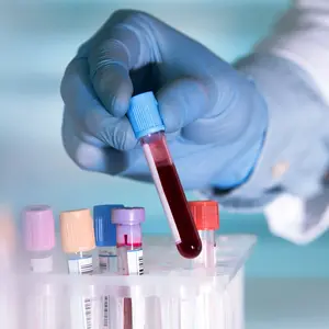 Lab technician holding blood tube sample for study