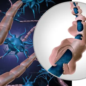 Myelin sheath degrading, which causes MS