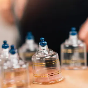 cupping therapy on patient's back